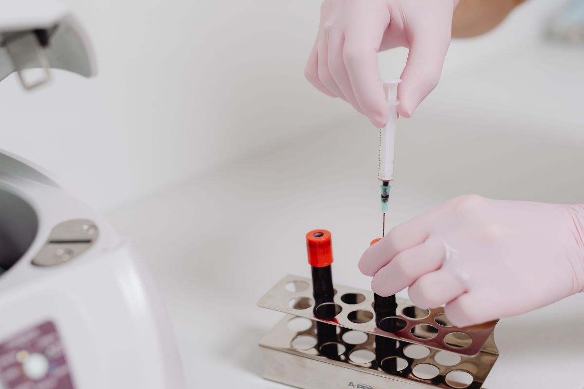 PRP ovarien et fertilité : promesse innovante ou traitement encore expérimental ?